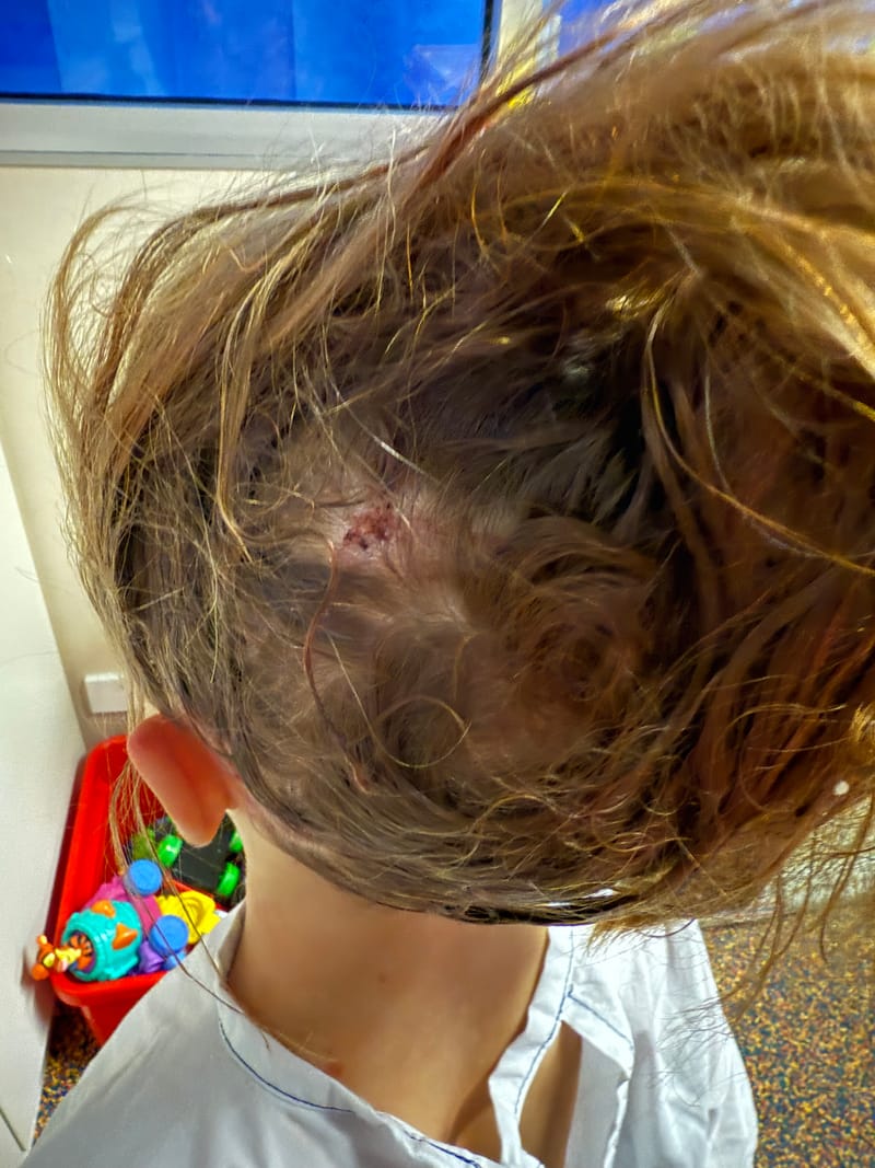 Child the victim of latest dog park attack post image